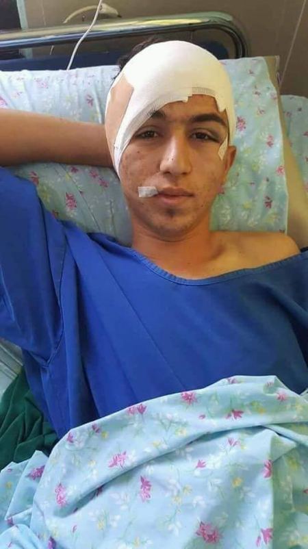 الخطأ الطبي هو نتيجه تتدهور صحة الشاب محمد عبد الإله جرار