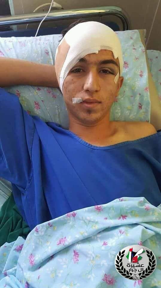 الخطأ الطبي هو نتيجه تتدهور صحة الشاب محمد عبد الإله جرار